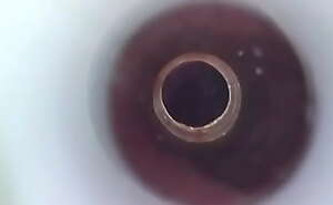 Endoscope camera in my urethra